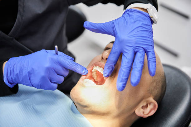 Best Broken Tooth Emergency  in Aurora, MO